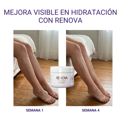 RENOVA — Crema Corporal Reparadora - 200ml
