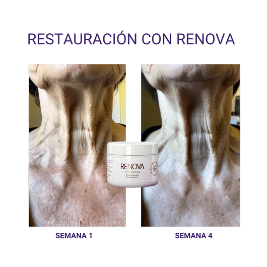 RENOVA — Crema Corporal Reparadora - 200ml