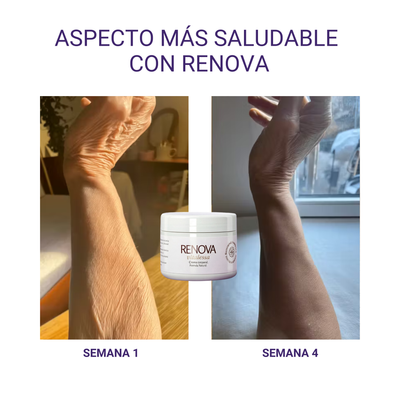 RENOVA — Crema Corporal Reparadora - 200ml