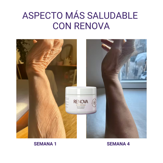 RENOVA — Crema Corporal Reparadora - 200ml