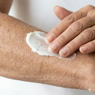 Ataca la causa hormonal, no el síntoma