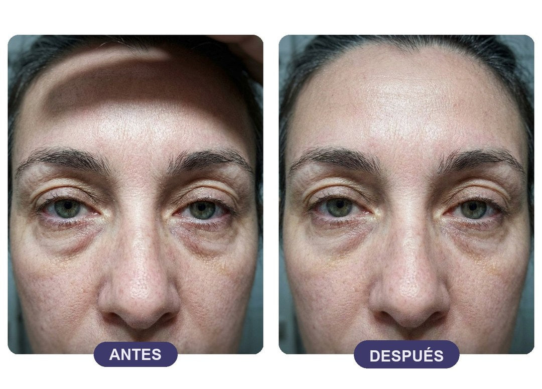 Contorno de ojos antes y después con Confort+